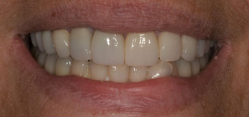 denti sani