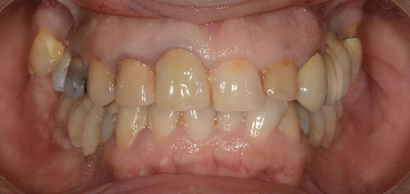 denti da curare